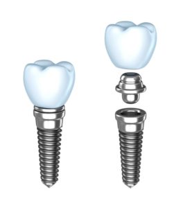 implant crown and tooth implant
